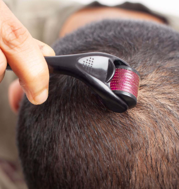 How to Use Minoxidil and Derma Roller for Beard and Hair Growth